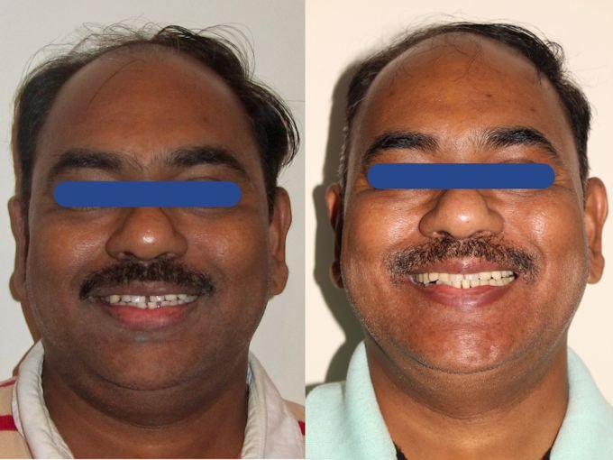 Dental Treatment Journey