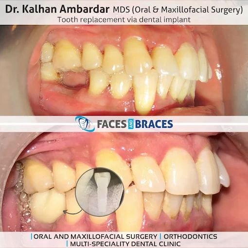Smile Restoration Case